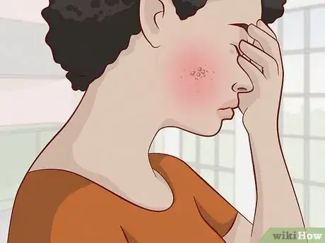 Image titled Reduce Acne Pain Step 10