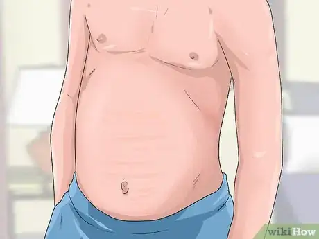 Image titled Diagnose Stiff Skin Syndrome Step 1