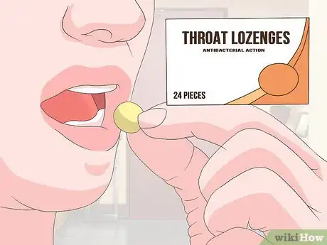 Image titled Undergo Somnoplasty Step 12