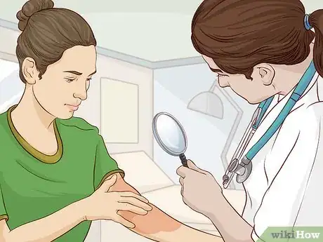 Image titled Treat Sunburn with Natural Remedies Step 8