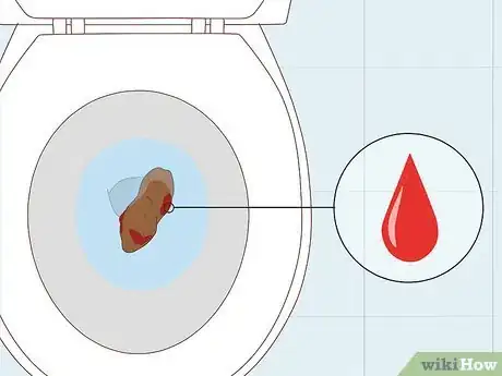 Image titled Treat Campylobacter Step 13