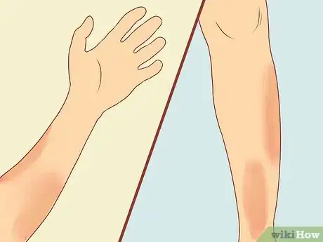 Image titled Prevent Common Krav Maga Injuries Step 15