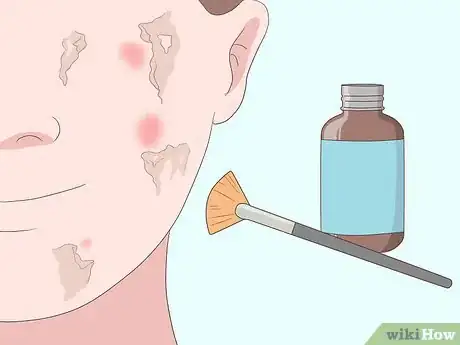 Image titled Get Rid of Sunspots Step 6