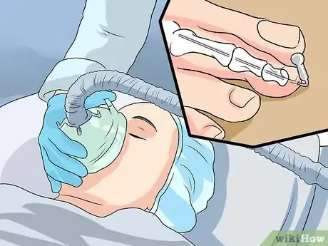 Image titled Treat Post Traumatic Arthritis Step 10