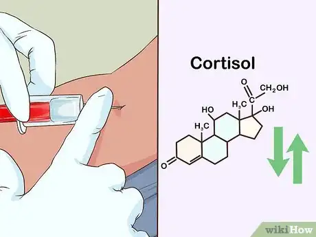 Image titled Test Cortisol Levels Step 9