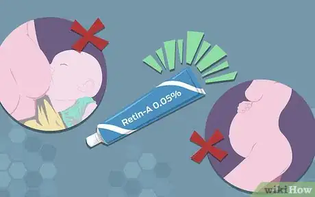 Image titled Get Rid of Razor Bumps in the Bikini Area Step 5