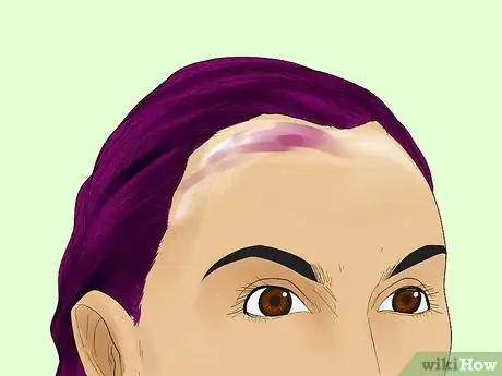 Image titled Remove Hair Dye from Your Scalp Step 12