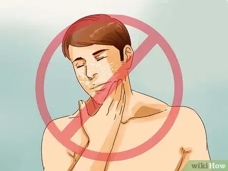 Image titled Clear Under the Skin Pimples Step 12