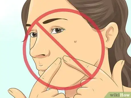 Image titled Stop Getting Acne in the Same Spot Step 5