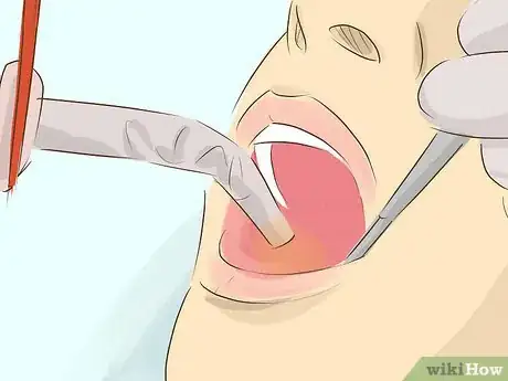 Image titled Treat Oral Cancer Step 8