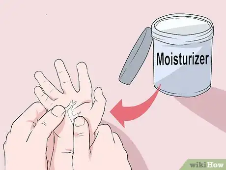Image titled Treat Burns in Infants Step 11