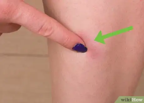 Image titled Use Lavender for Skin Care Step 7