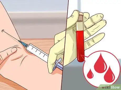 Image titled Detect Helicobacter Pylori Step 4