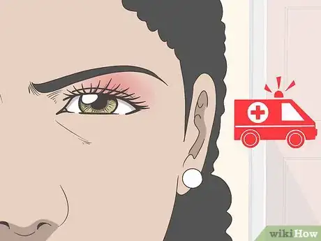 Image titled Treat Eye Sunburn Step 5