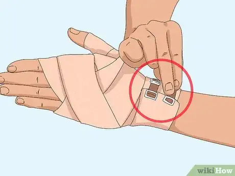 Image titled Wrap a Sprained Thumb Step 11