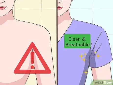 Image titled Prevent Skin Tags Step 1