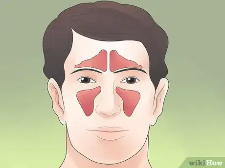 Image titled Stop Sinus Headaches Step 3