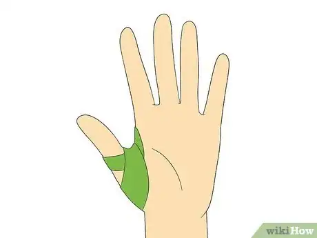 Image titled Do a Hook Grip Step 9