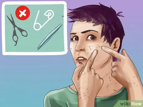 Image titled Stop Dermatillomania Step 8