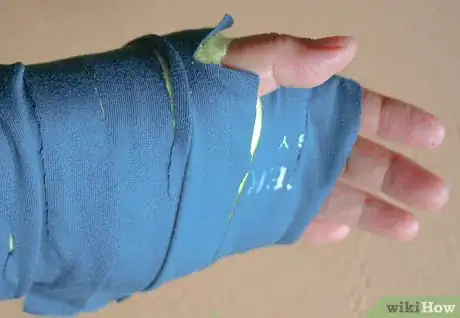 Image titled Make a Fake Arm Cast Step 31
