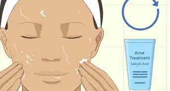 Treat Whiteheads
