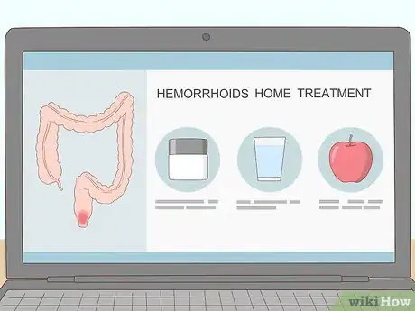 Image titled Get Rid of Hemorrhoids Fast Step 4