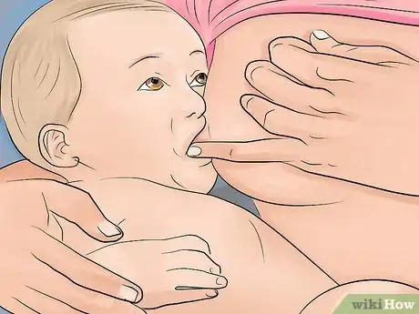 Image titled Stop a Breast Feeding Baby From Biting Step 9
