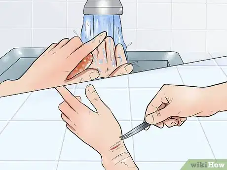 Image titled Care for a Cut Step 3