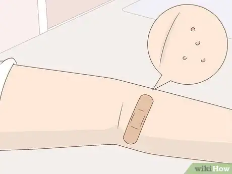 Image titled Prevent Molluscum (Molluscum Contagiosum) Step 4