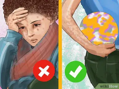 Image titled Stop Dermatillomania Step 7