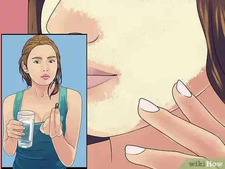 Image titled Manage Polycystic Ovary Syndrome (PCOS) Step 6