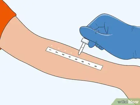 Image titled Treat Eczema with Diet Step 2