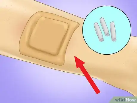 Image titled Undergo Testosterone Therapy Step 6