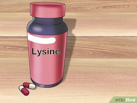 Image titled Treat Cold Sores in Your Nose Step 8