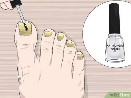 Image titled Do a Nail Treatment Step 2