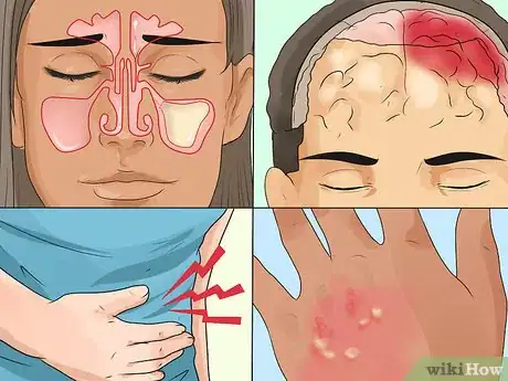 Image titled Diagnose Primary Immunodeficiency Step 1