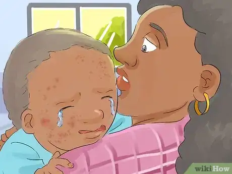 Image titled Recognize and Treat Kawasaki Disease Step 2