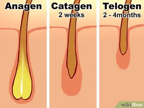 Image titled Treat Female Hair Loss Step 3