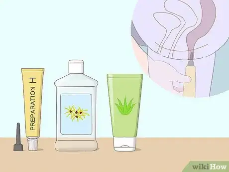 Image titled Get Rid of Hemorrhoids Fast Step 6