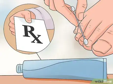 Image titled Cure Nail Fungus Step 11